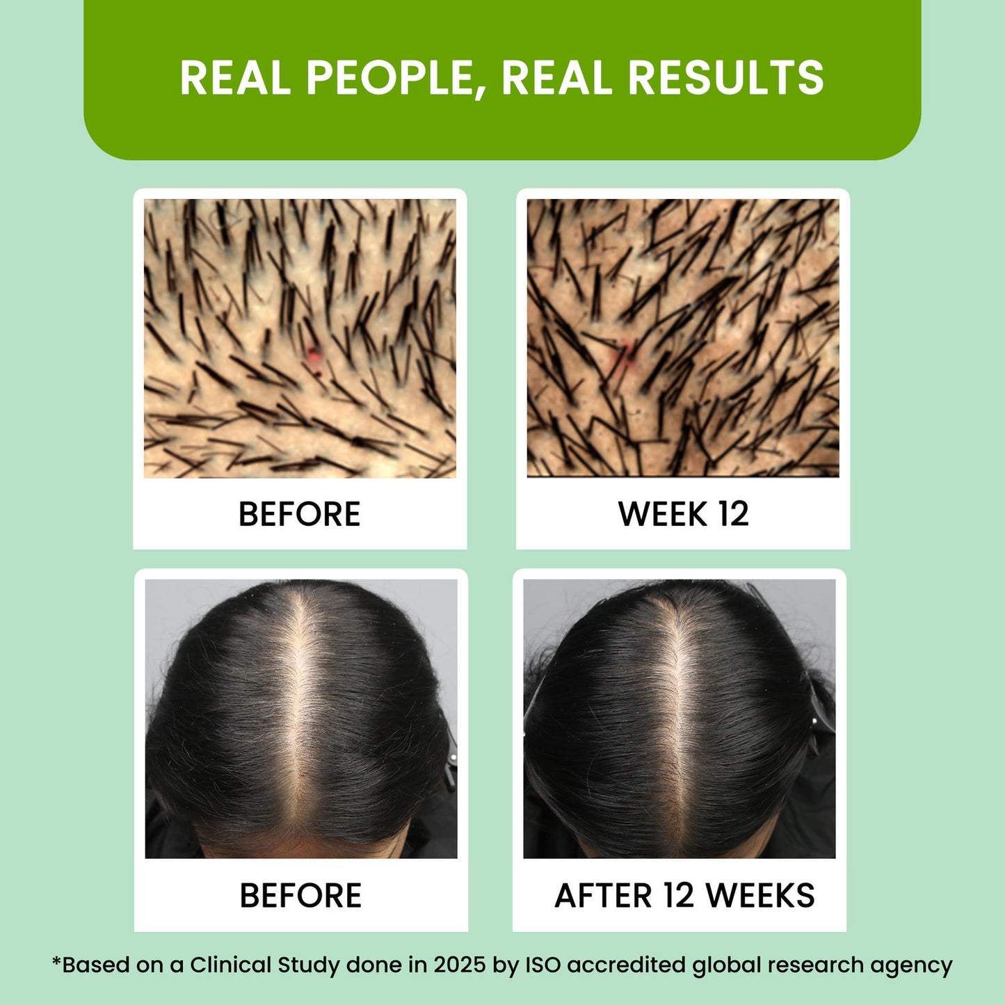 Rosemary Water, Hair Spray For Regrowth (Pack of 3)